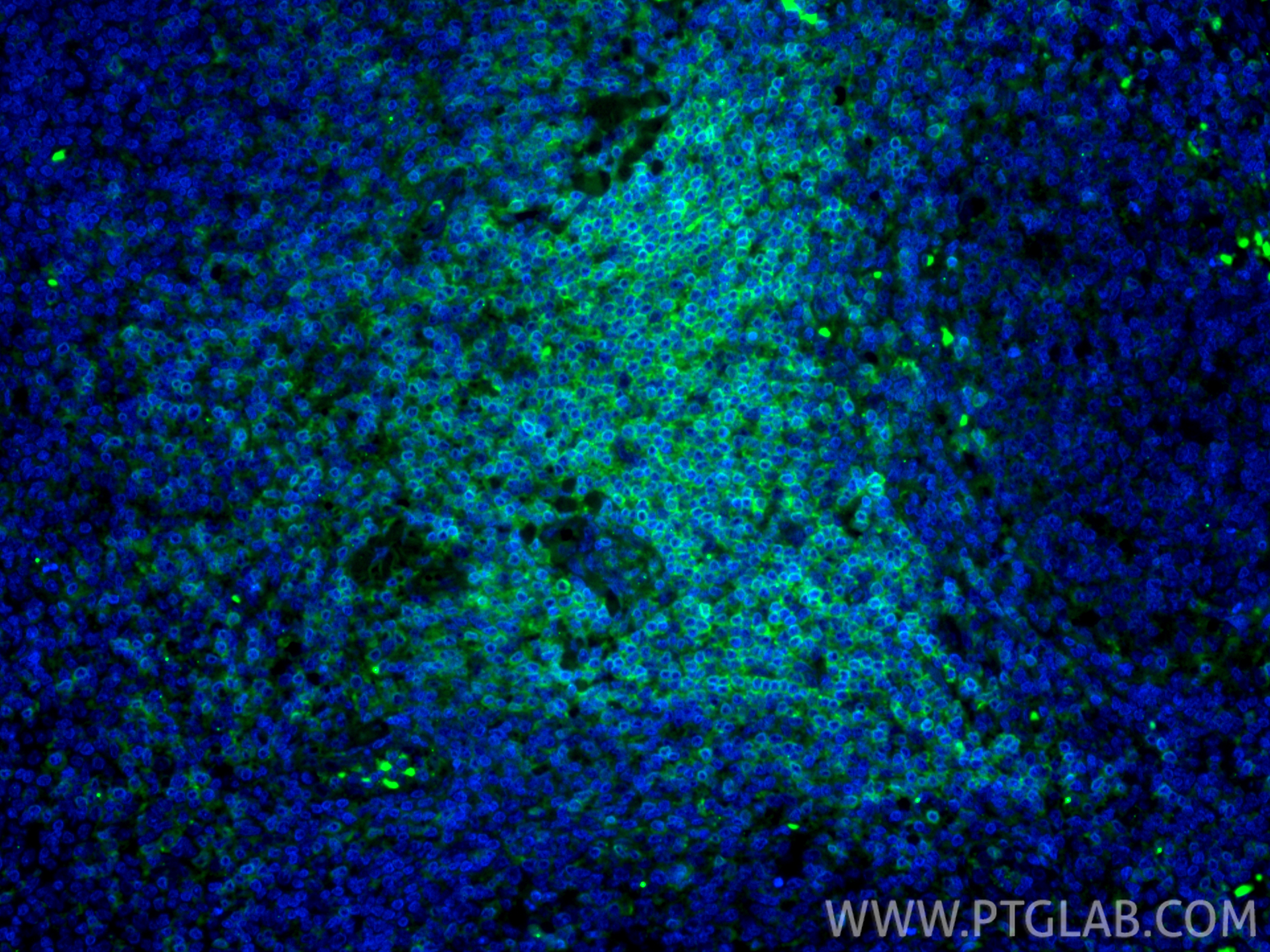 Immunofluorescent analysis of (4% PFA) fixed paraffin-embedded human tonsillitis tissue using CoraLite® Plus 488 CD3 antibody (CL488-84505-4, Clone: 242012G2 ) at dilution of 1:200. Heat mediated antigen retrieval with Tris-EDTA buffer (pH 9.0). IF Staining of human tonsillitis using CL488-84505-4
