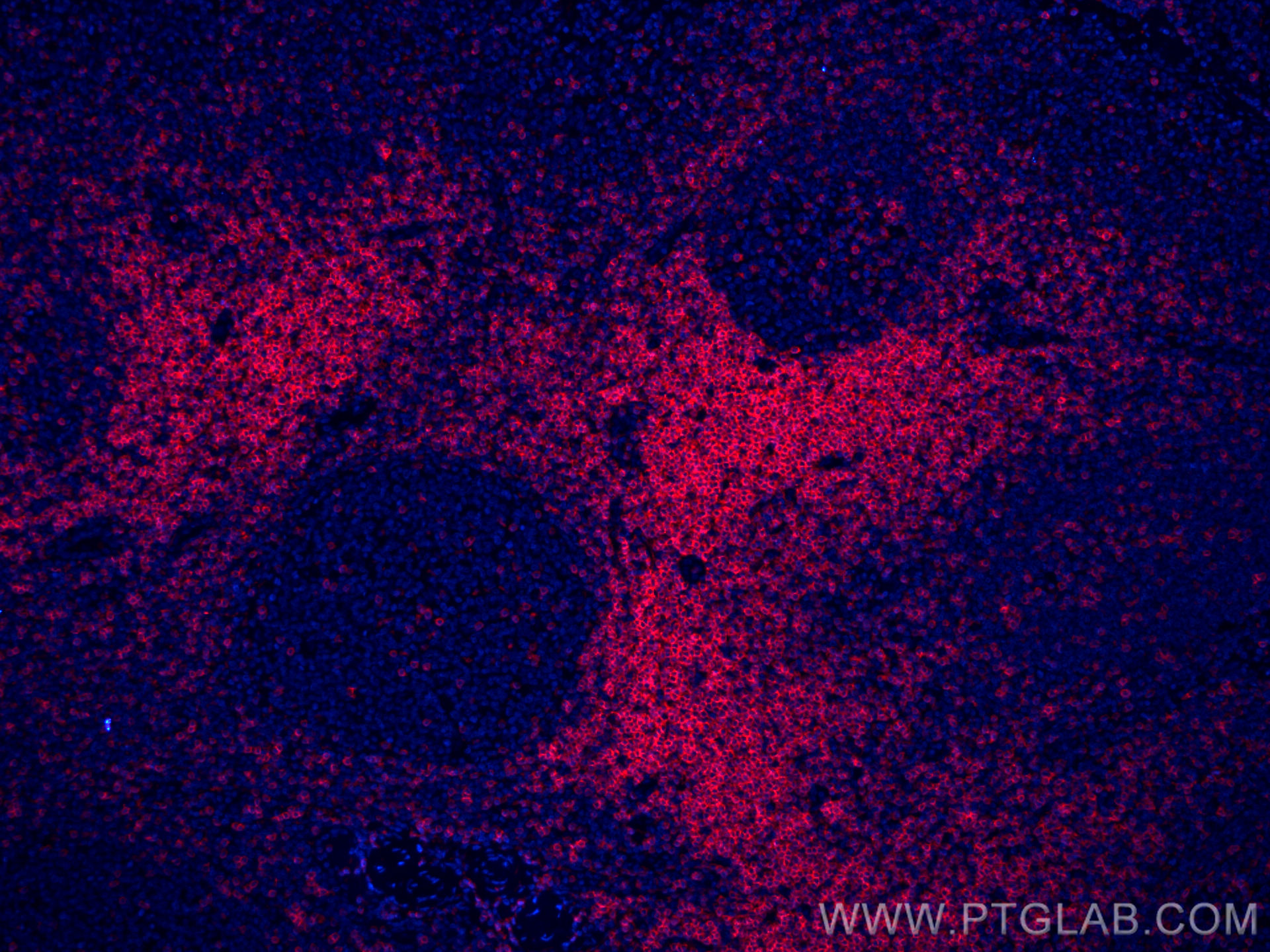 IF Staining of human tonsillitis using CL594-60181