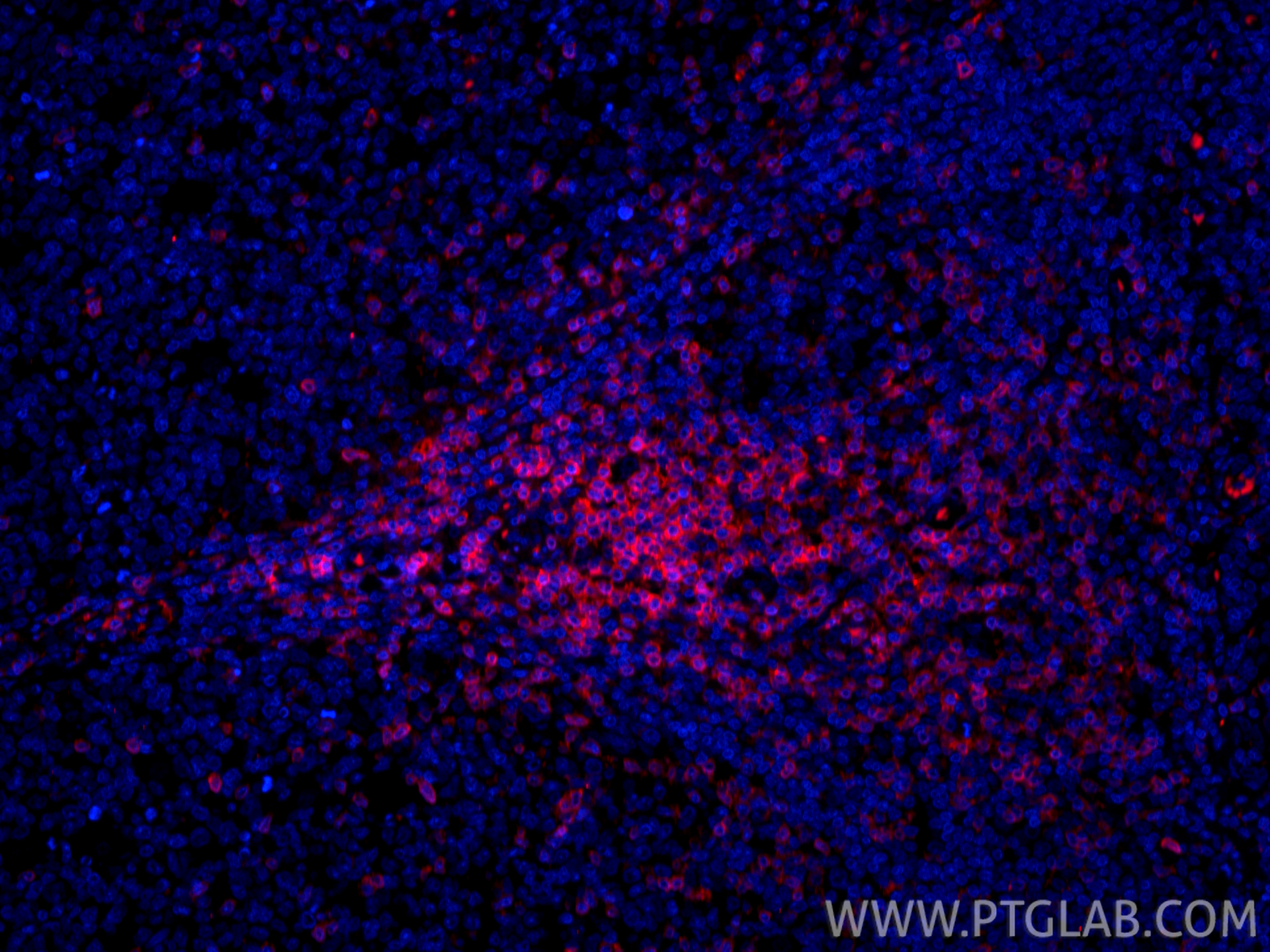 Immunofluorescent analysis of (4% PFA) fixed paraffin-embedded human tonsillitis tissue using CoraLite®594 CD3 antibody (CL594-84505-4, Clone: 242012G2 ) at dilution of 1:200. Heat mediated antigen retrieval with Tris-EDTA buffer (pH 9.0). IF Staining of human tonsillitis using CL594-84505-4