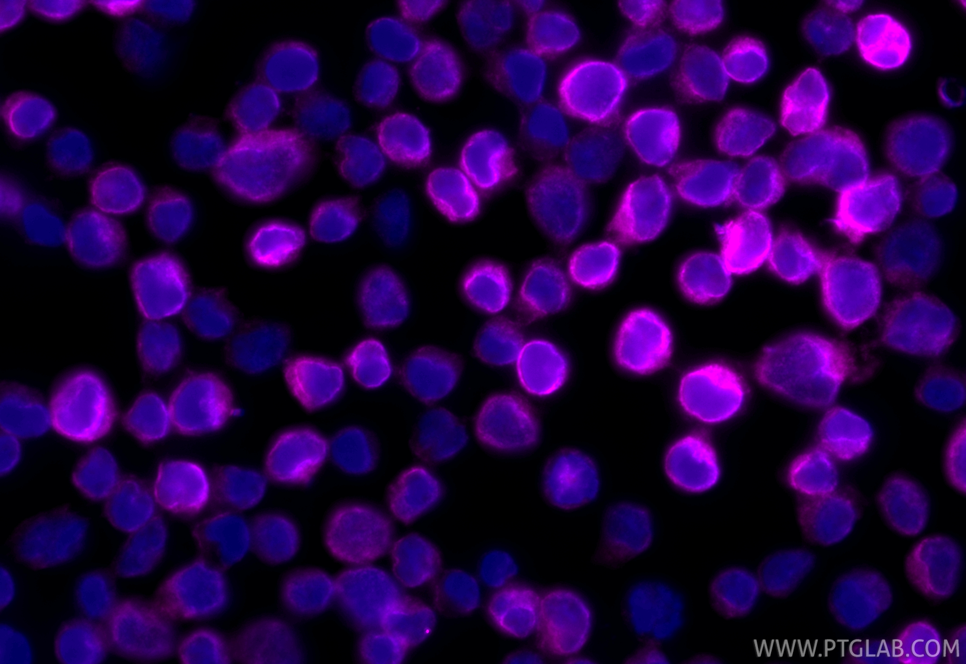 Immunofluorescent analysis of (4% PFA) fixed Jurkat cells using CoraLite® Plus 647 CD3 antibody (CL647-84505-4, Clone: 242012G2 ) at dilution of 1:200. IF Staining of Jurkat using CL647-84505-4