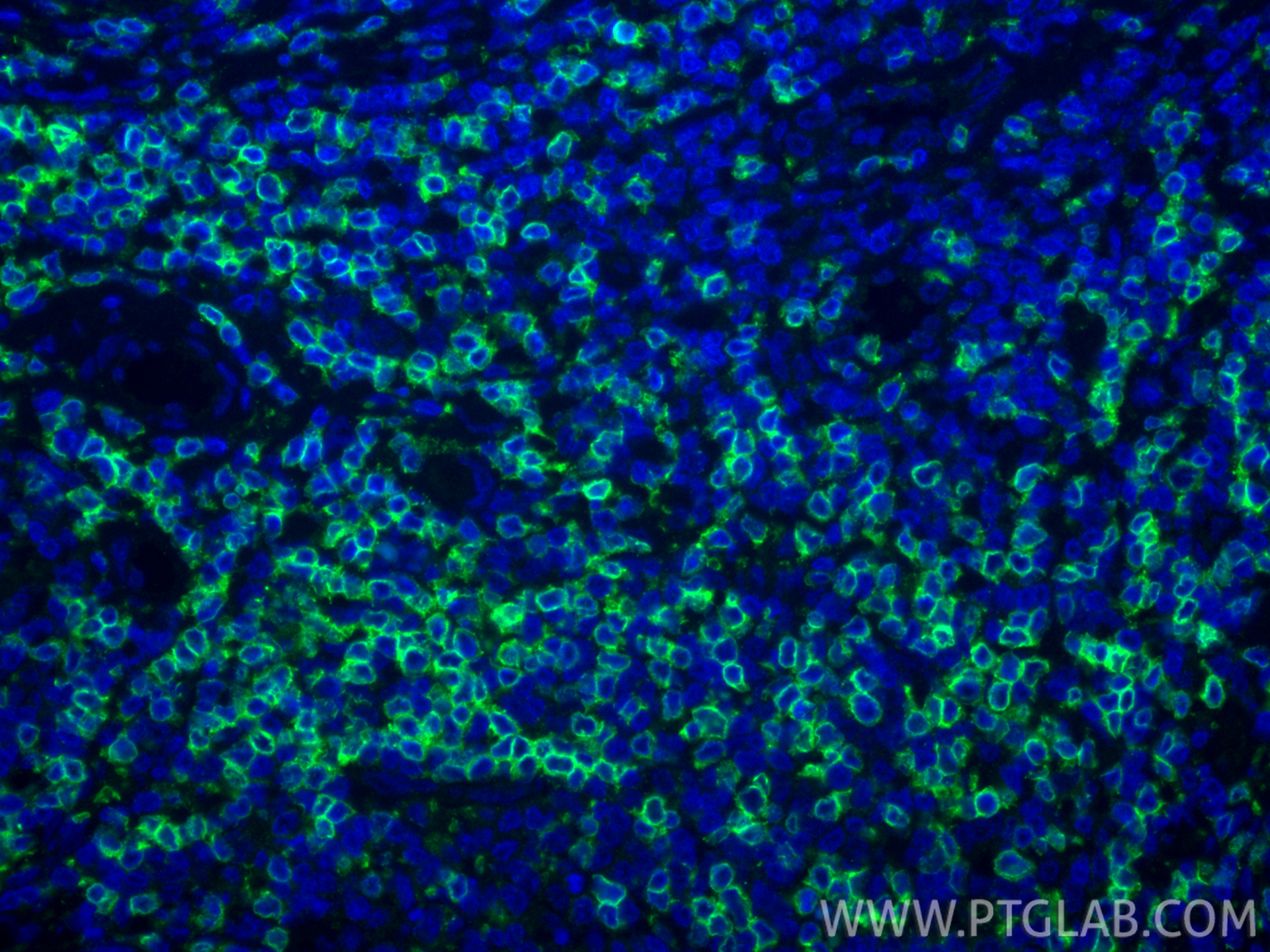 Immunofluorescent analysis of (4% PFA) fixed paraffin-embedded human tonsillitis tissue using CD3 Delta antibody (<a class='green' href='/productredirect?CatalogNo=84214-4-RR' target='_blank'>84214-4-RR</a>, Clone: 241523H2 ) at dilution of 1:200 and CoraLite®488-Conjugated Goat Anti-Rabbit IgG(H+L) (<a class='green' href='/productredirect?CatalogNo=SA00013-2' target='_blank'>SA00013-2</a>). Heat mediated antigen retrieval with Tris-EDTA buffer (pH 9.0). This data was developed using the same antibody clone with 84214-4-PBS in a different storage buffer formulation. IF Staining of human tonsillitis using 84214-4-RR (same clone as 84214-4-PBS)