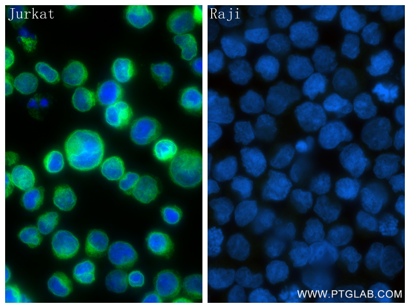 IF Staining of Jurkat using 84836-1-RR (same clone as 84836-1-PBS)