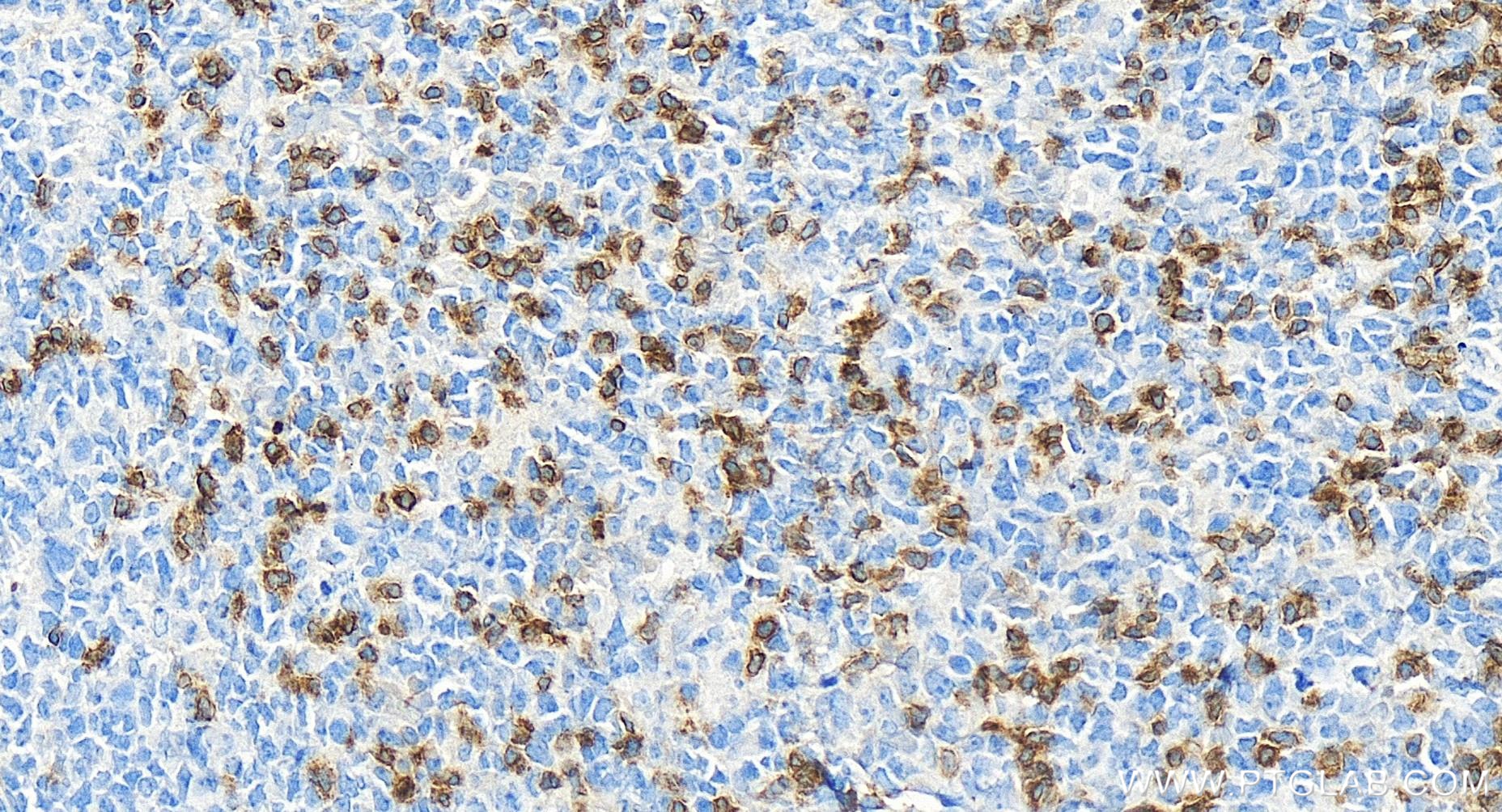 CD3 Gamma