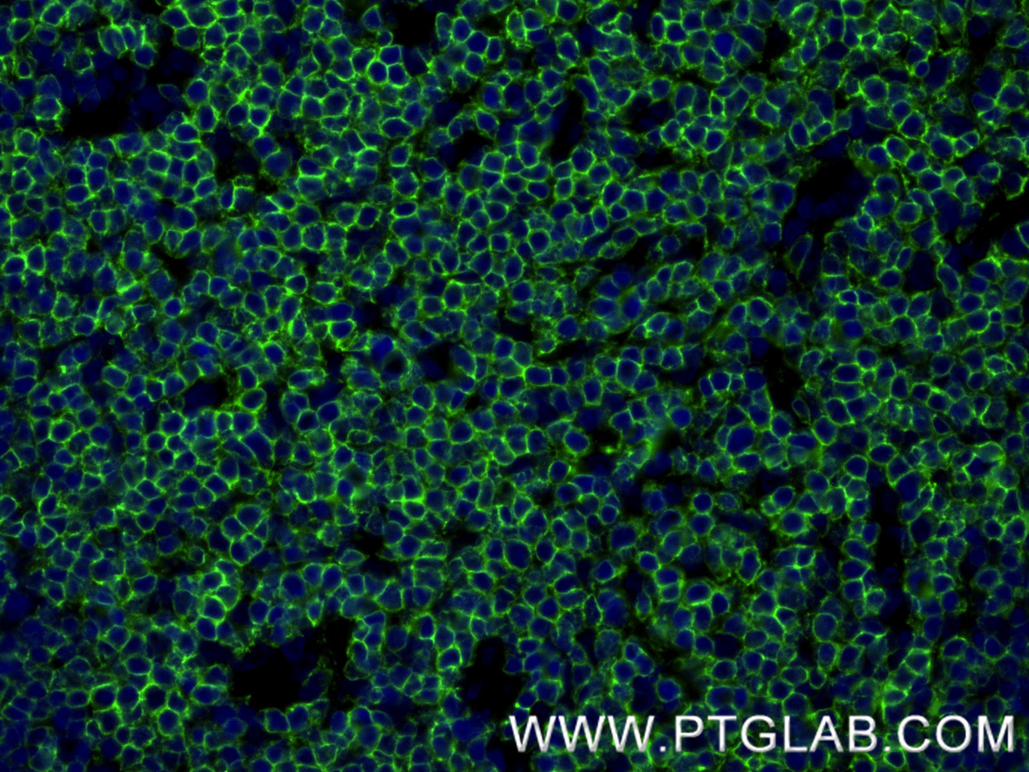 IF Staining of rat thymus using 86053-1-RR