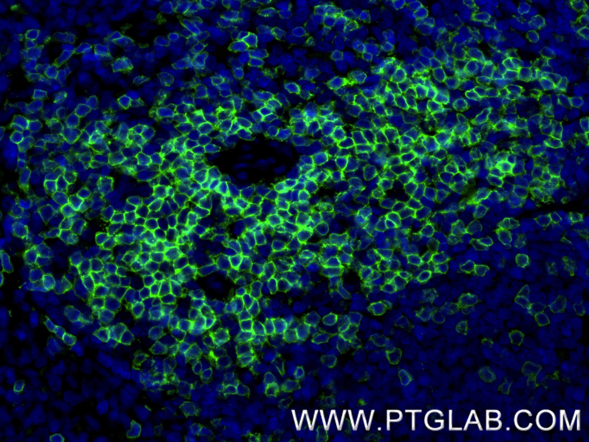 IF Staining of rat spleen using 86053-1-RR