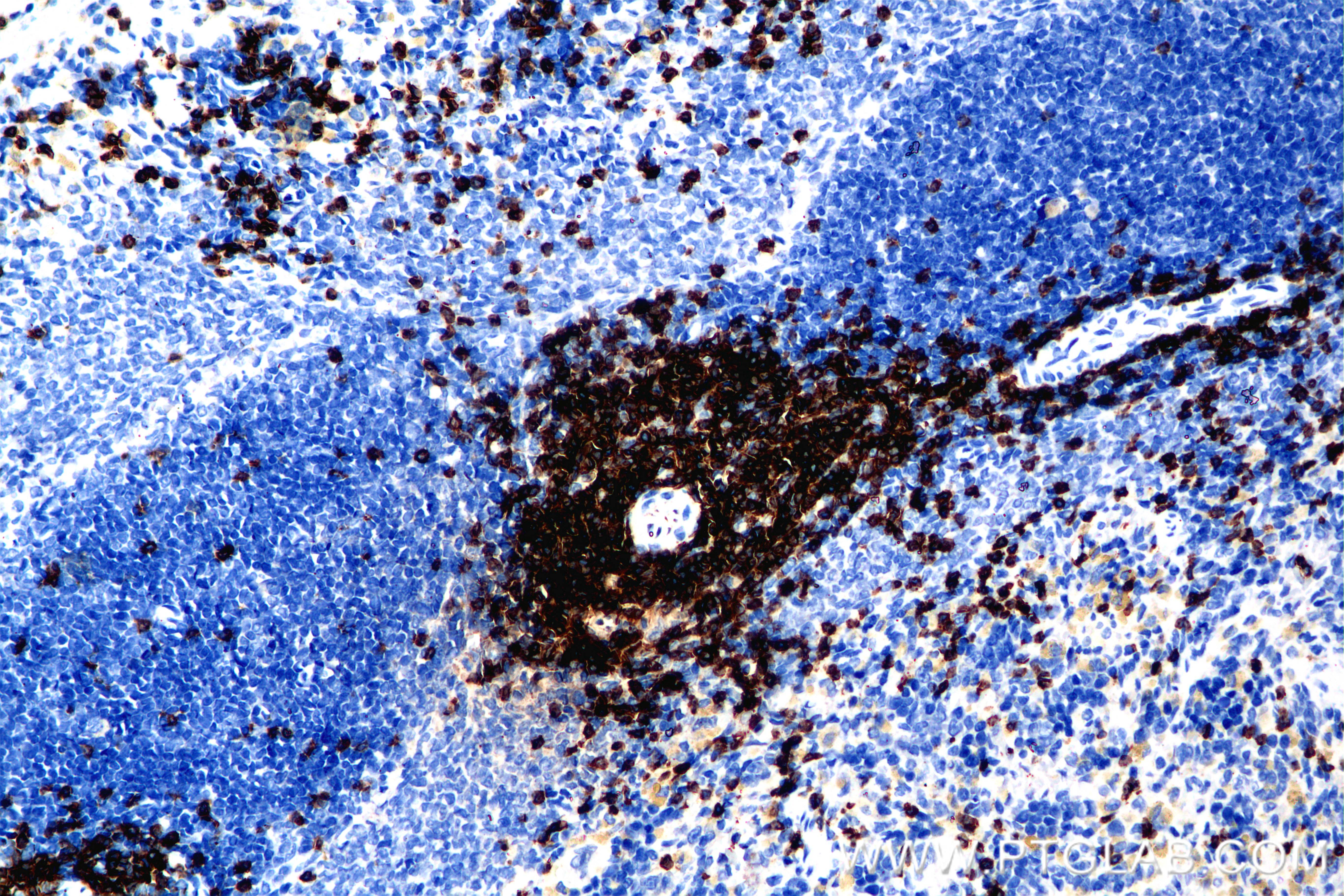 IHC staining of rat spleen using 86053-1-RR