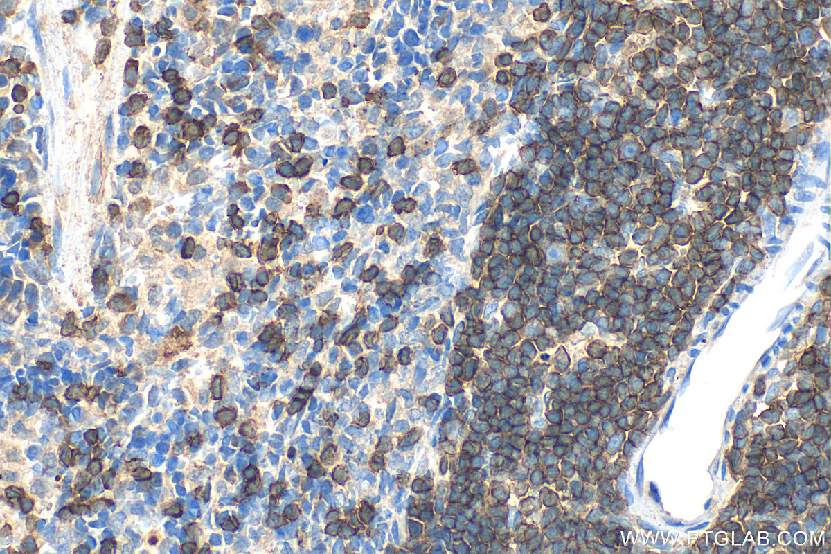 IHC staining of rat spleen using 31889-1-AP