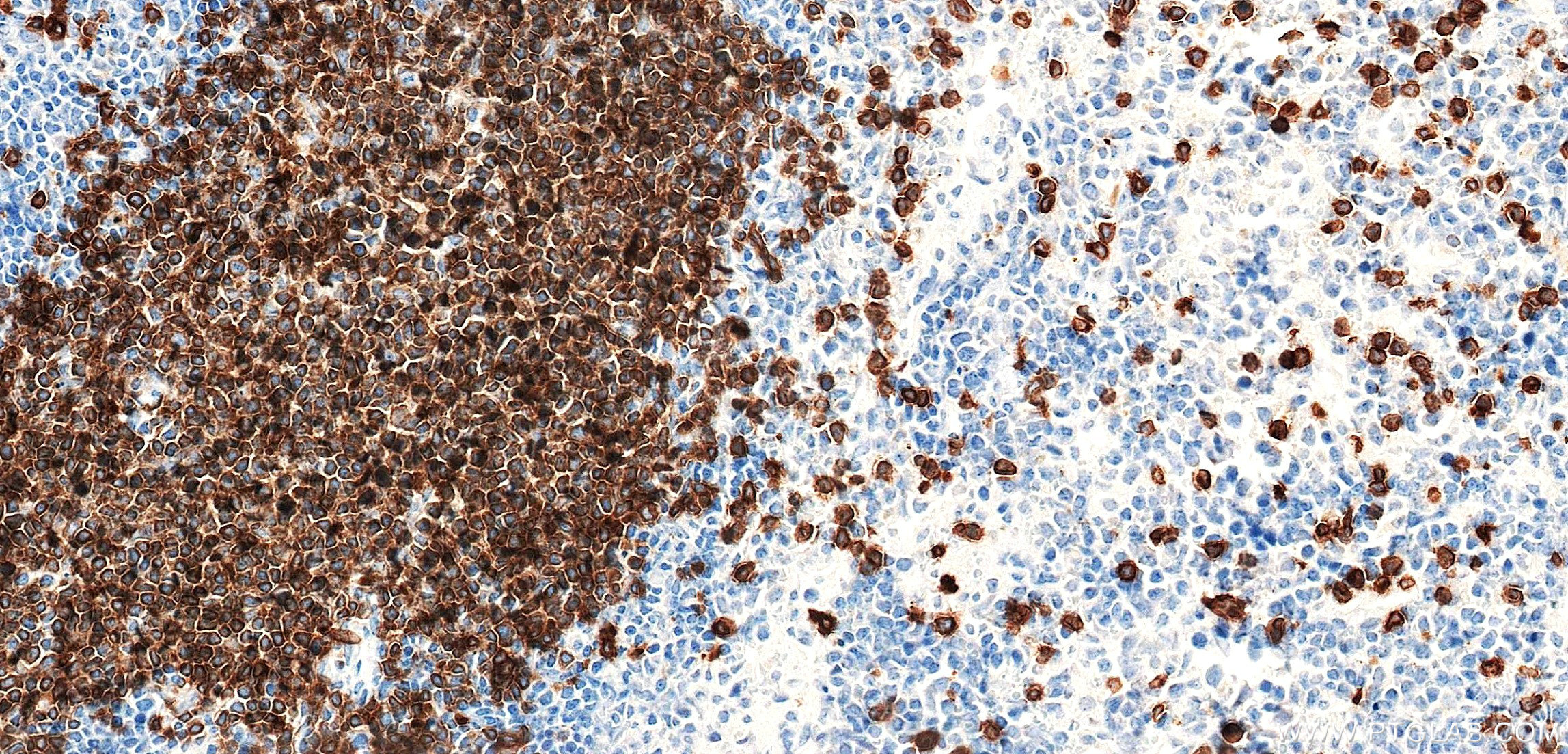 IHC staining of mouse spleen using 87861-1-RR IHC staining of mouse spleen using 87861-1-RR