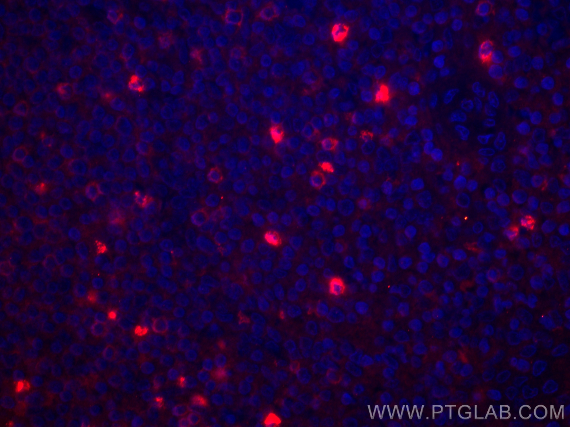 IF Staining of human tonsillitis using CL594-60347