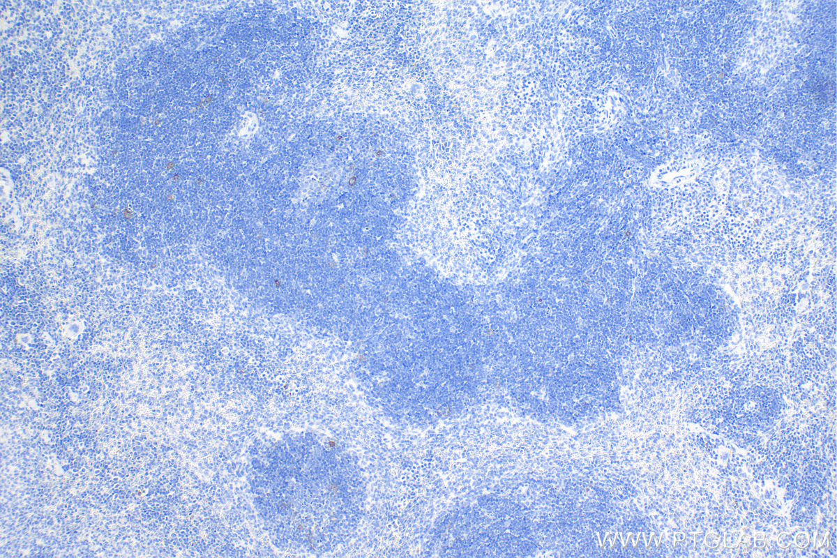 IHC staining of mouse spleen using 84420-6-RR