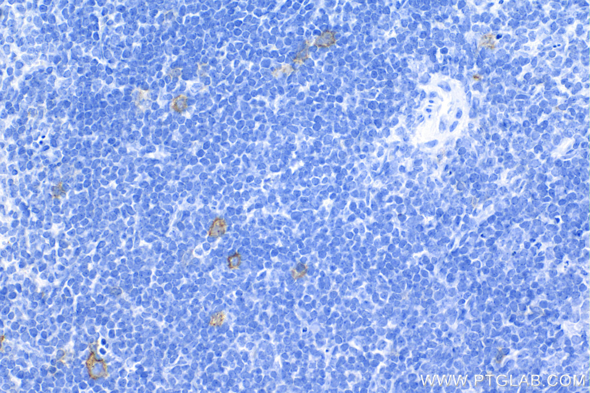 IHC staining of mouse spleen using 84420-6-RR