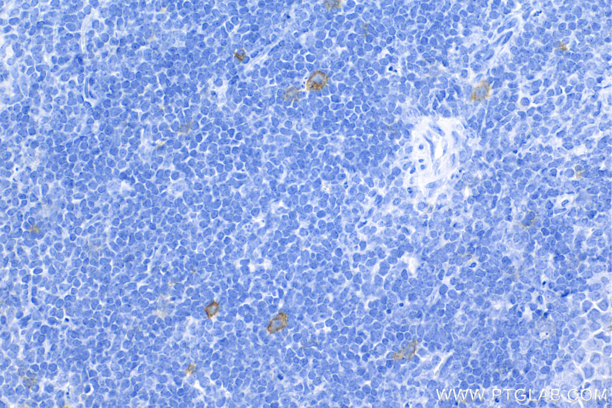 IHC staining of mouse spleen using 84420-7-RR