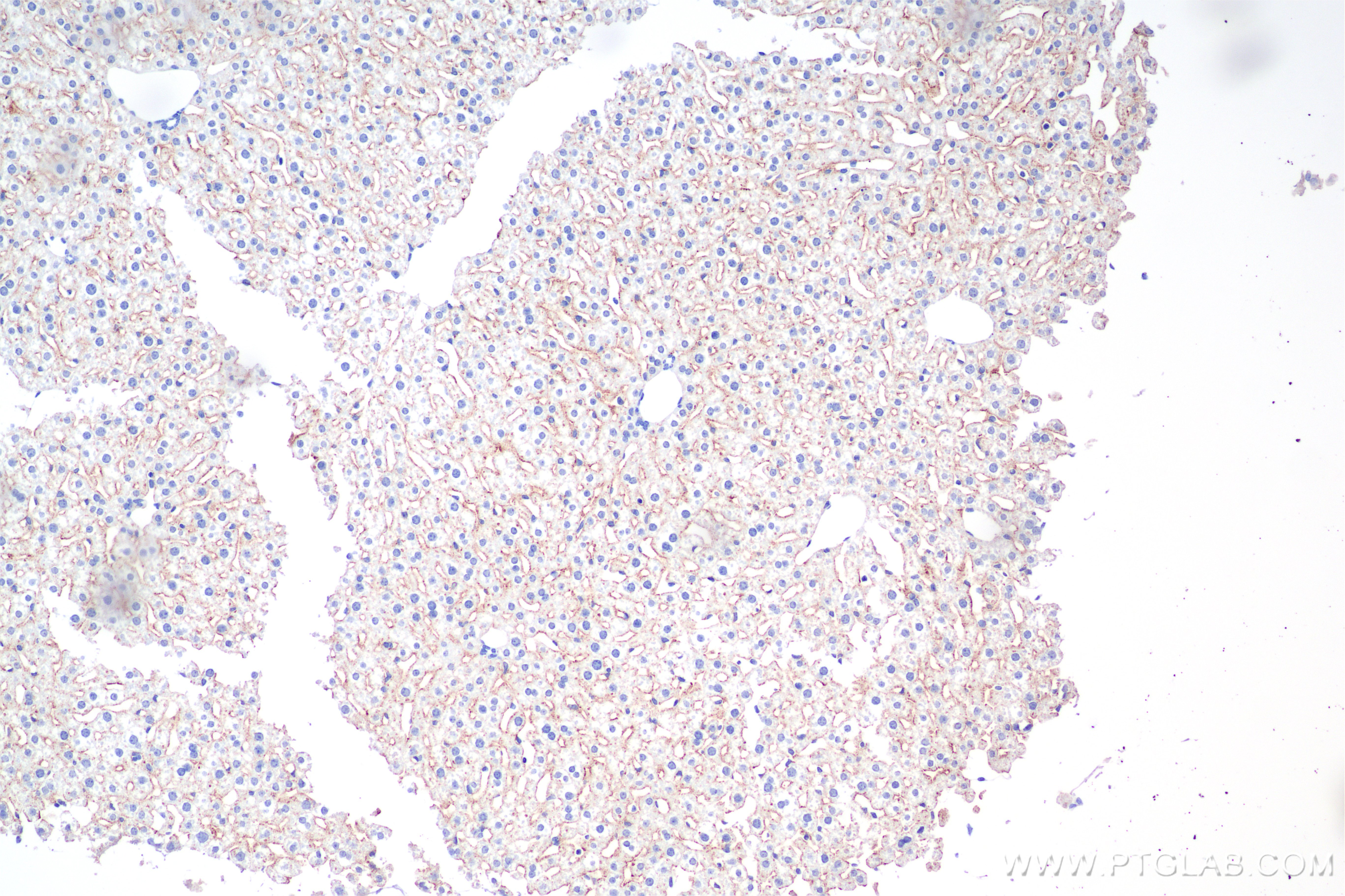 IHC staining of mouse liver using 85813-5-RR