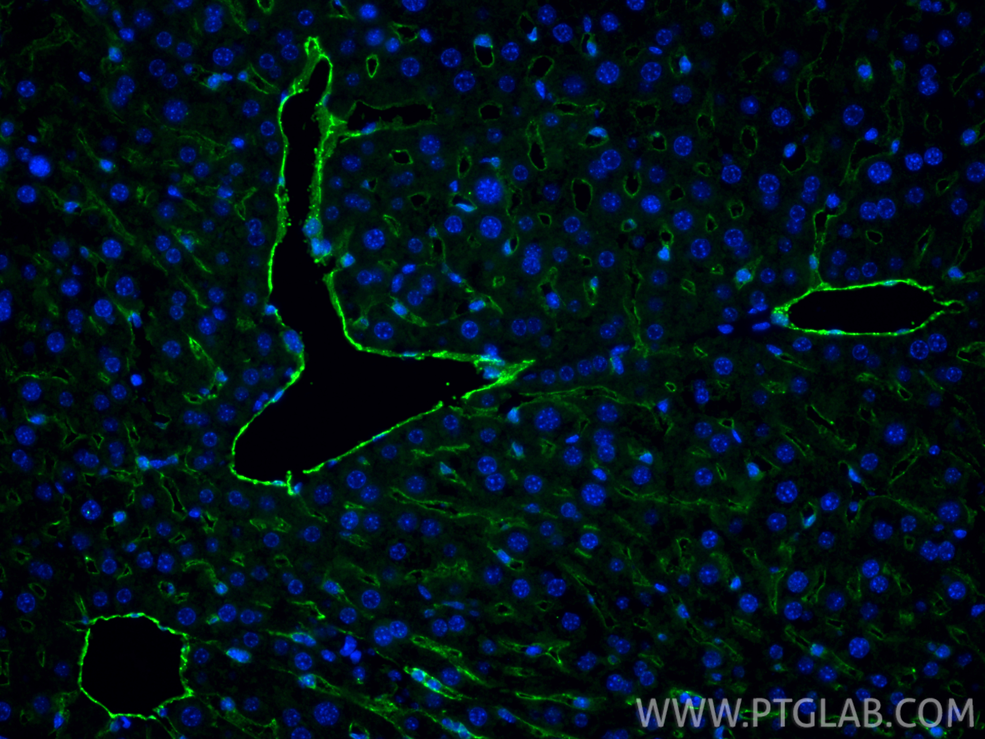 IF Staining of mouse liver using 32387-1-AP IF Staining of mouse liver using 32387-1-AP