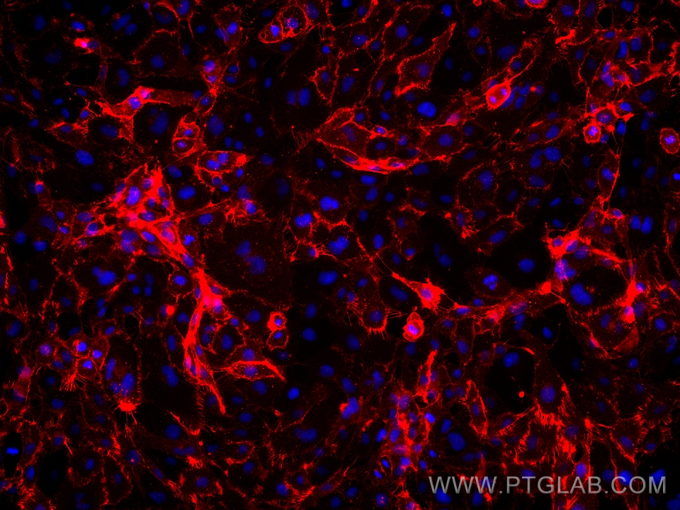 IF Staining of HUVEC using 65268-1-Ig