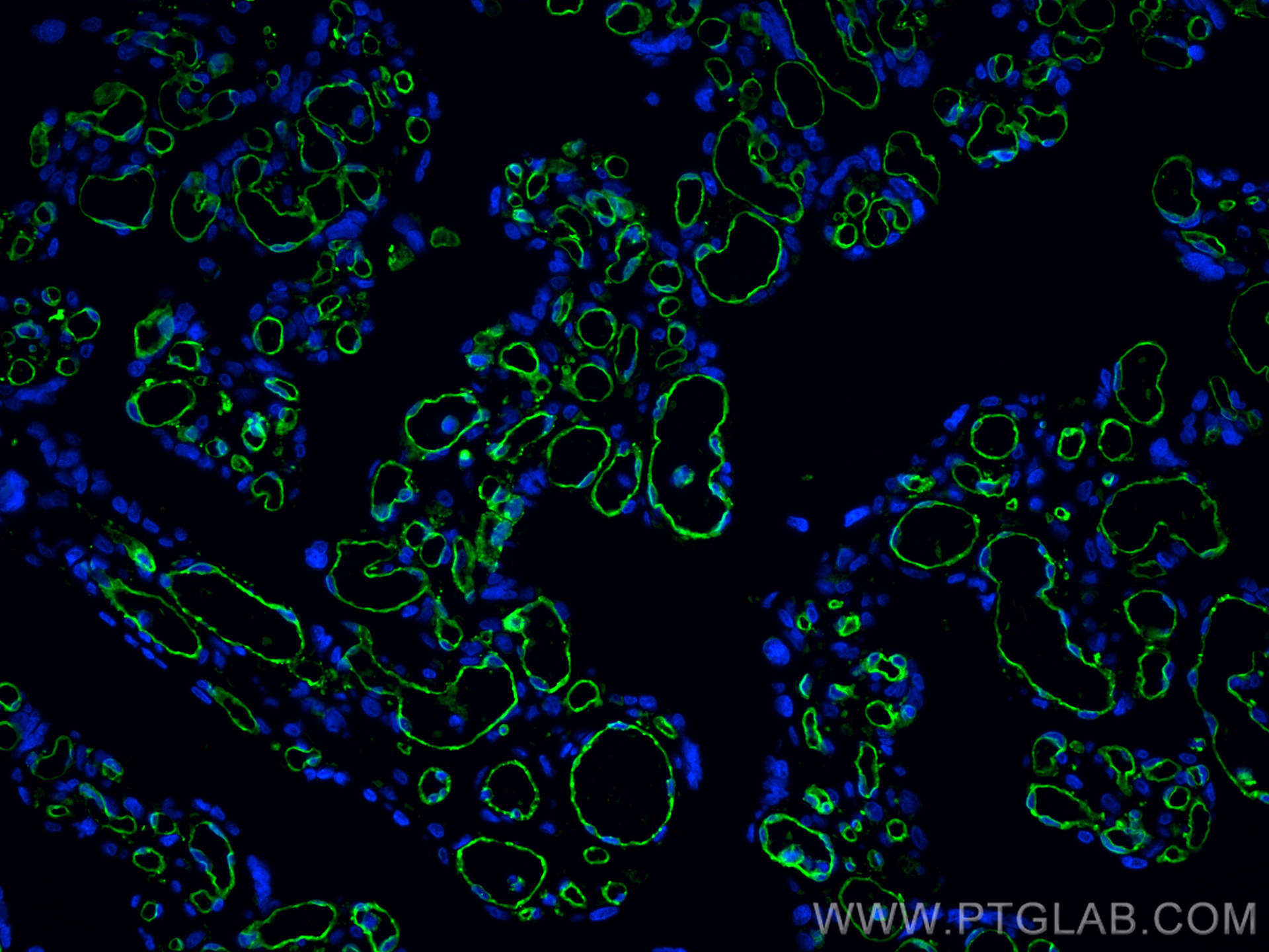 IF Staining of human placenta using 66065-2-Ig (same clone as 66065-2-PBS)