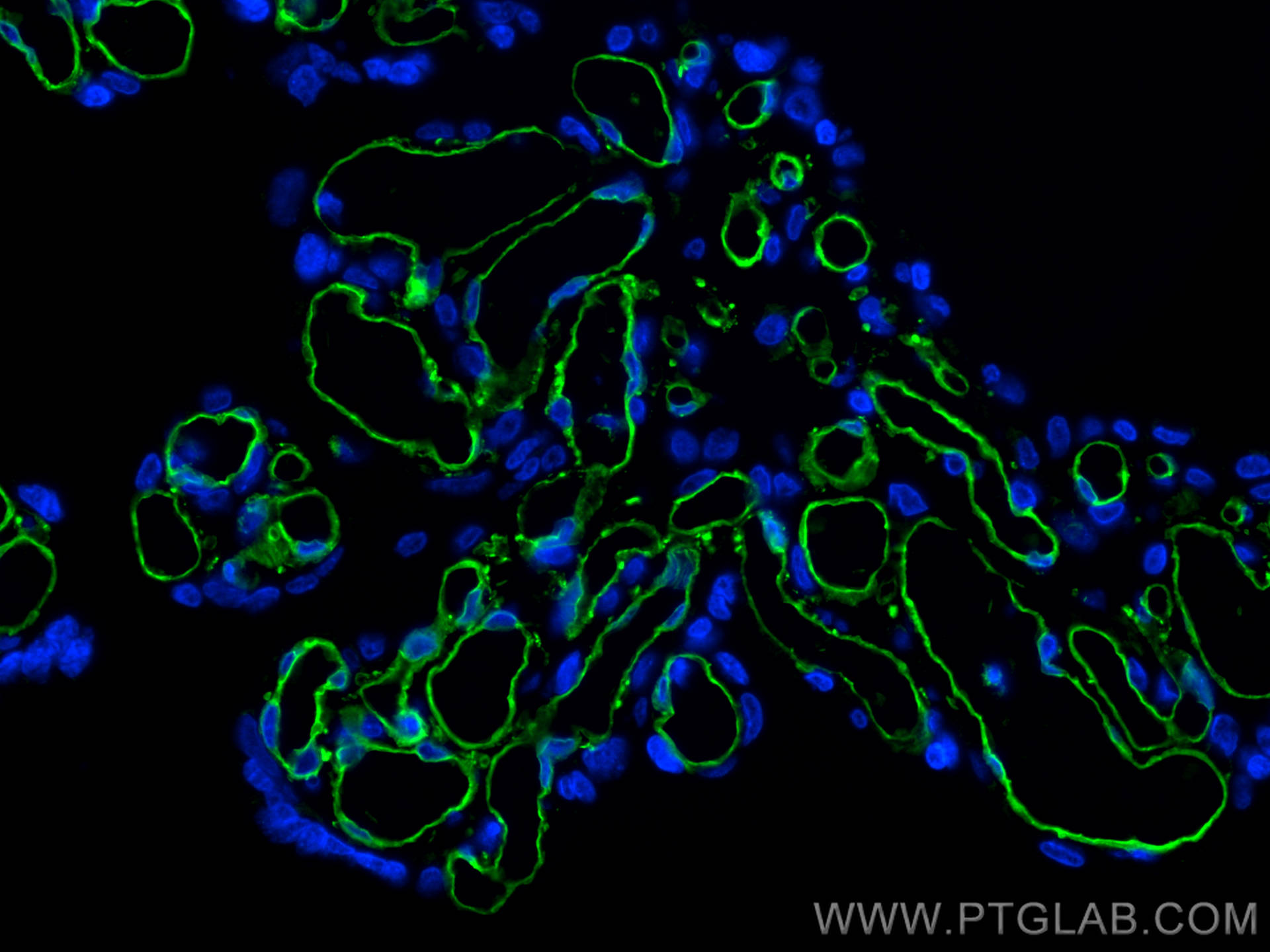 IF Staining of human placenta using 66065-2-Ig (same clone as 66065-2-PBS)