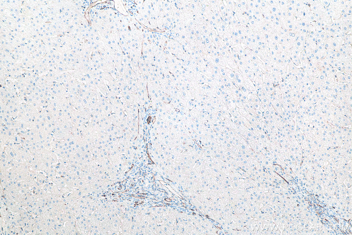 IHC staining of human liver using 66065-2-Ig