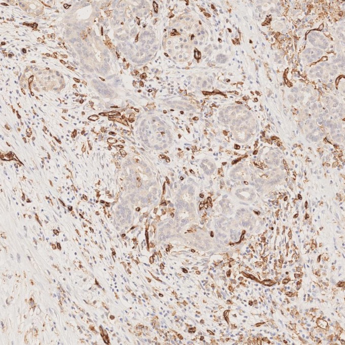 IHC staining of human pancreas using 66065-2-Ig
