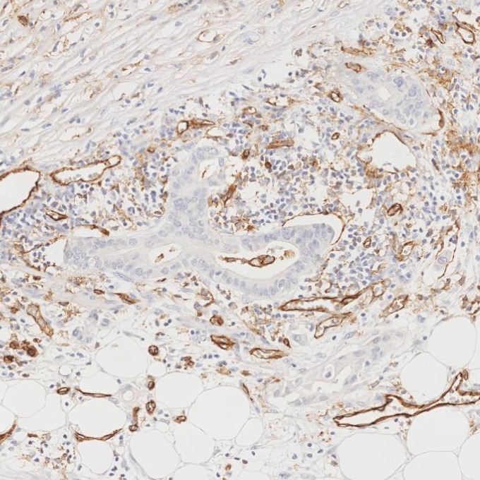IHC staining of human pancreas using 66065-2-Ig