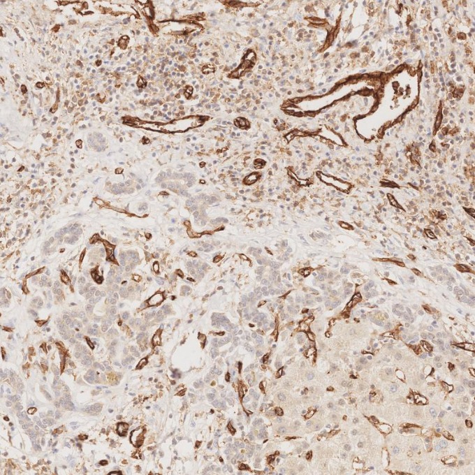 IHC staining of human liver using 66065-2-Ig