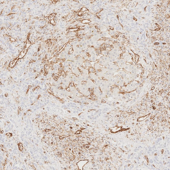 IHC staining of human liver using 66065-2-Ig