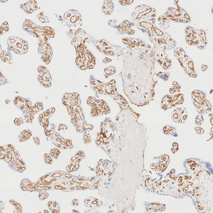 IHC staining of human placenta using 66065-2-Ig
