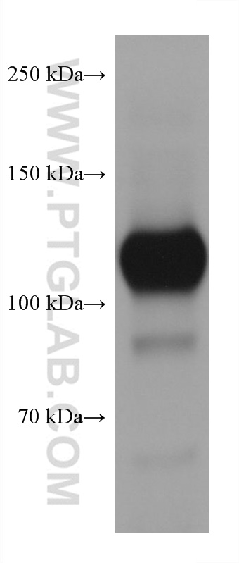 WB analysis of human peripheral blood platelets using 66065-2-Ig (same clone as 66065-2-PBS)