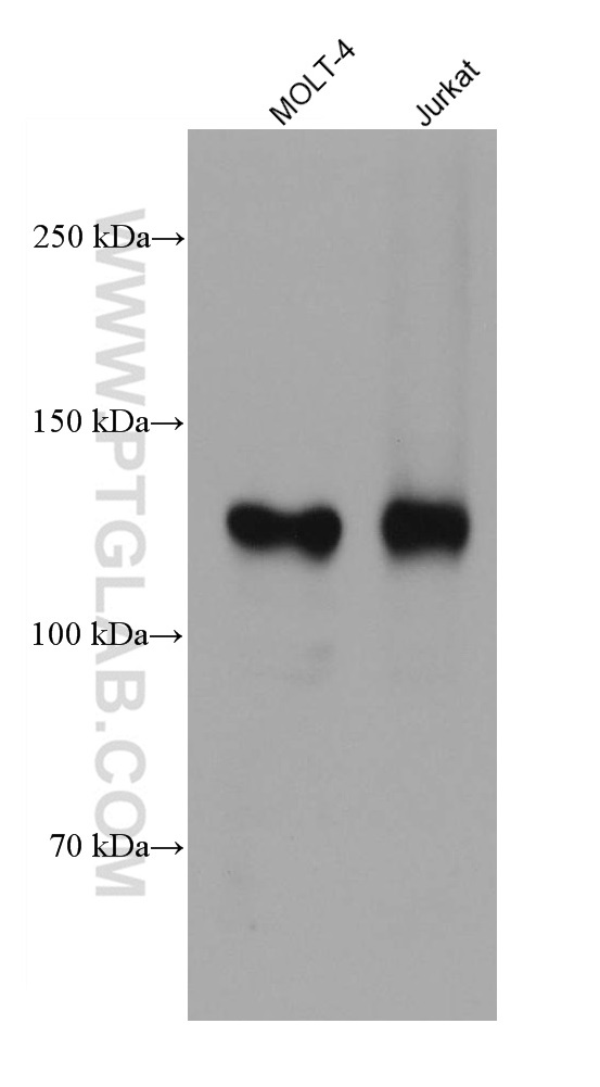 CD31