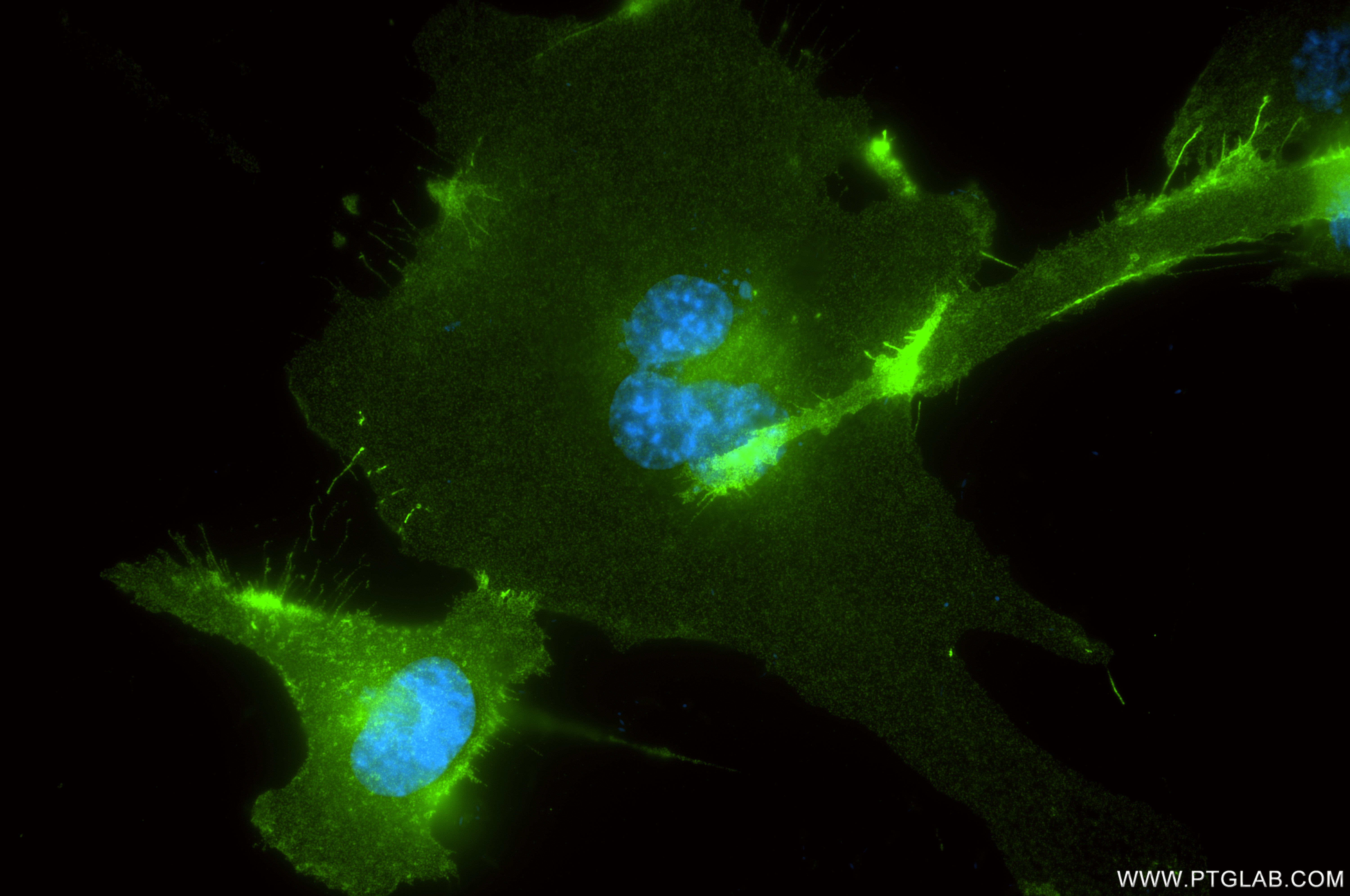 IF Staining of HUVEC using 80773-4-RR