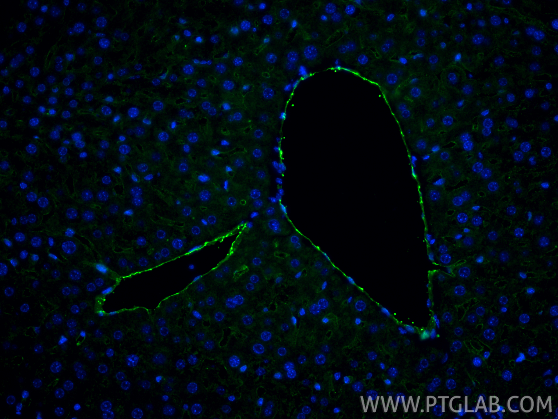 IF Staining of mouse liver using 84607-4-RR (same clone as 84607-4-PBS)