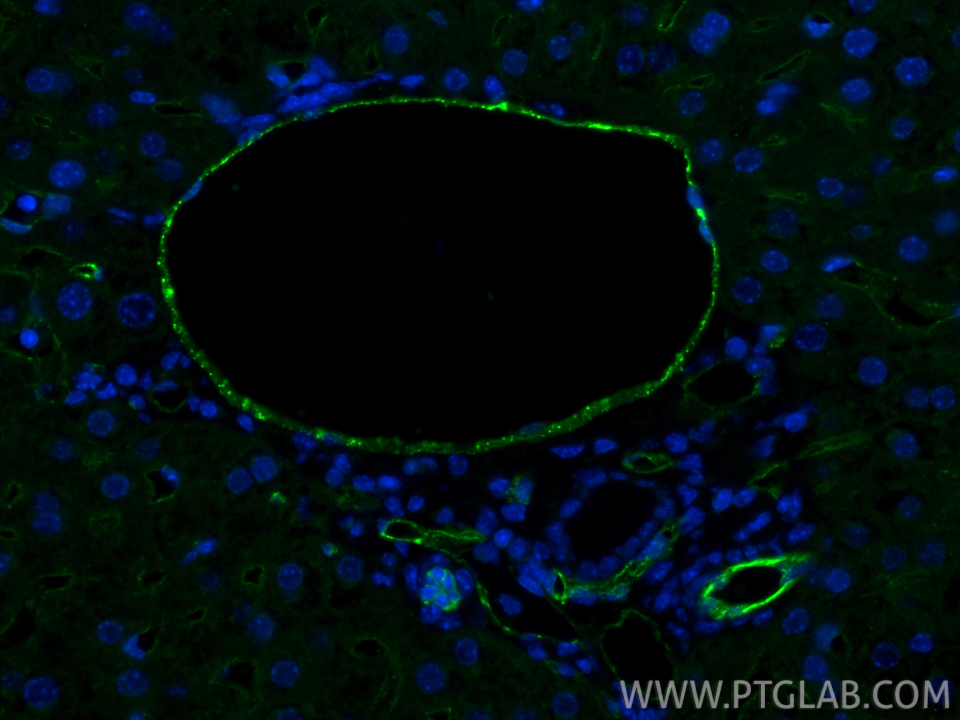 IF Staining of mouse liver using 84607-4-RR IF Staining of mouse liver using 84607-4-RR