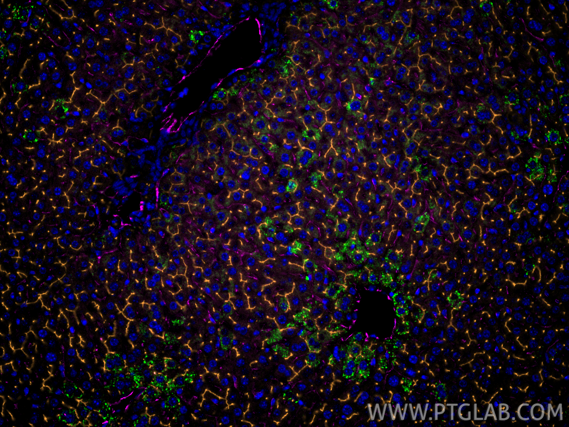 IF Staining of mouse liver using 84607-4-RR IF Staining of mouse liver using 84607-4-RR