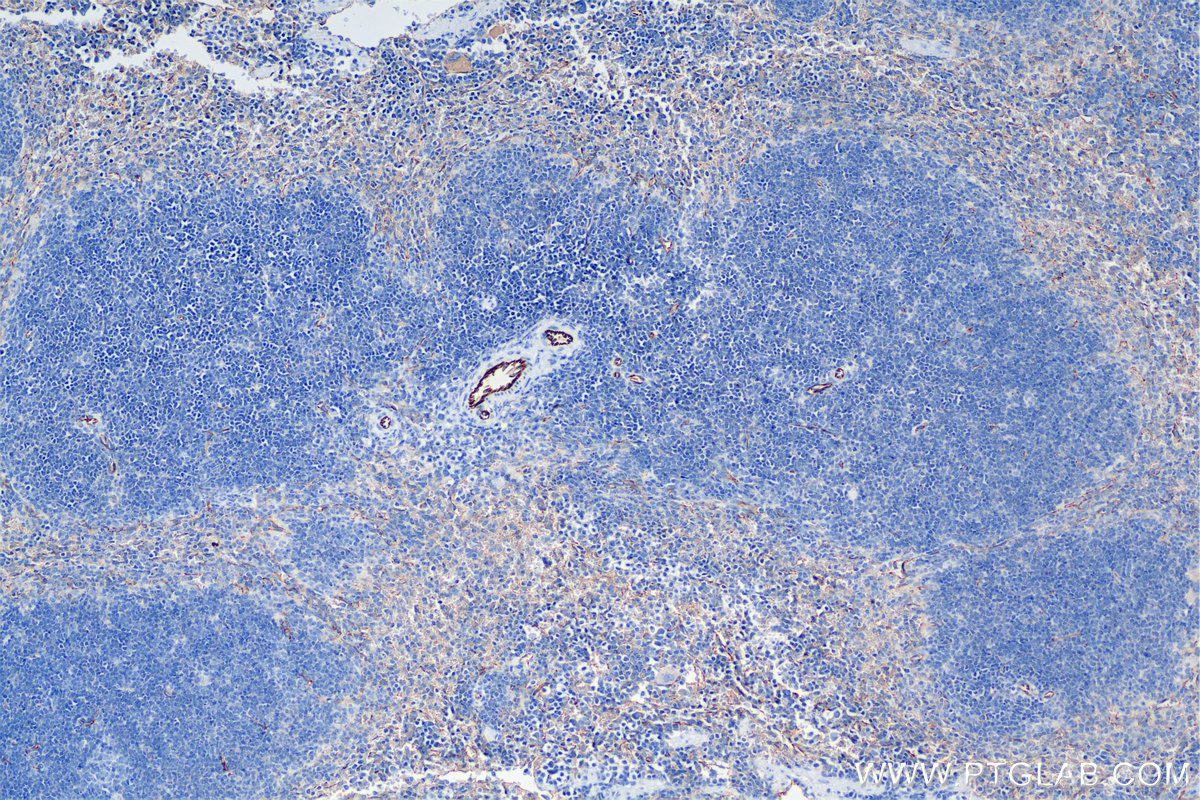 IHC staining of mouse spleen using 84607-4-RR (same clone as 84607-4-PBS)