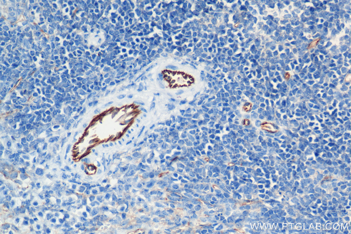 IHC staining of mouse spleen using 84607-4-RR (same clone as 84607-4-PBS)