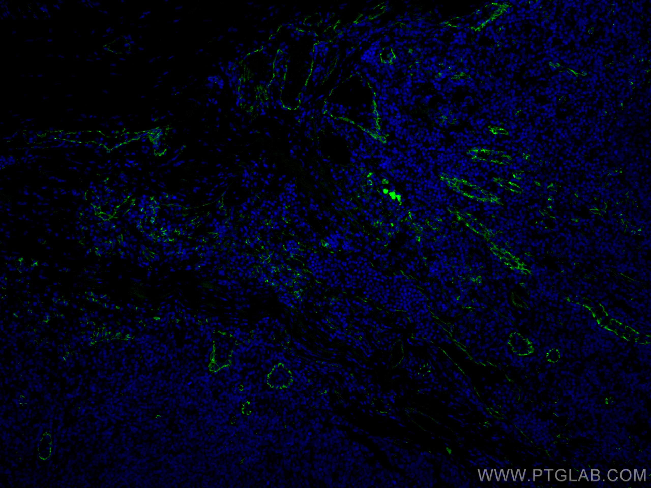 IF Staining of human tonsillitis using CL488-11265