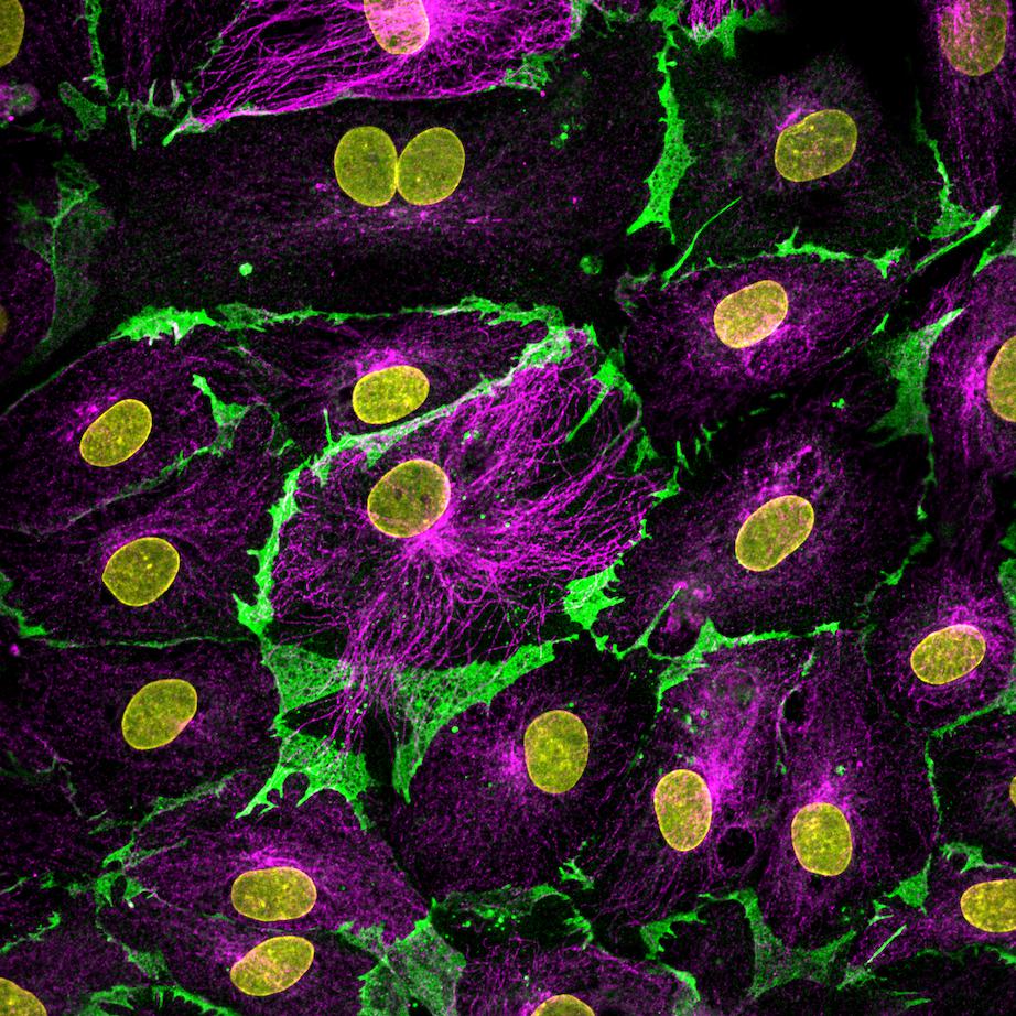 IF Staining of Lymphatic endothelial cells using CL488-66065