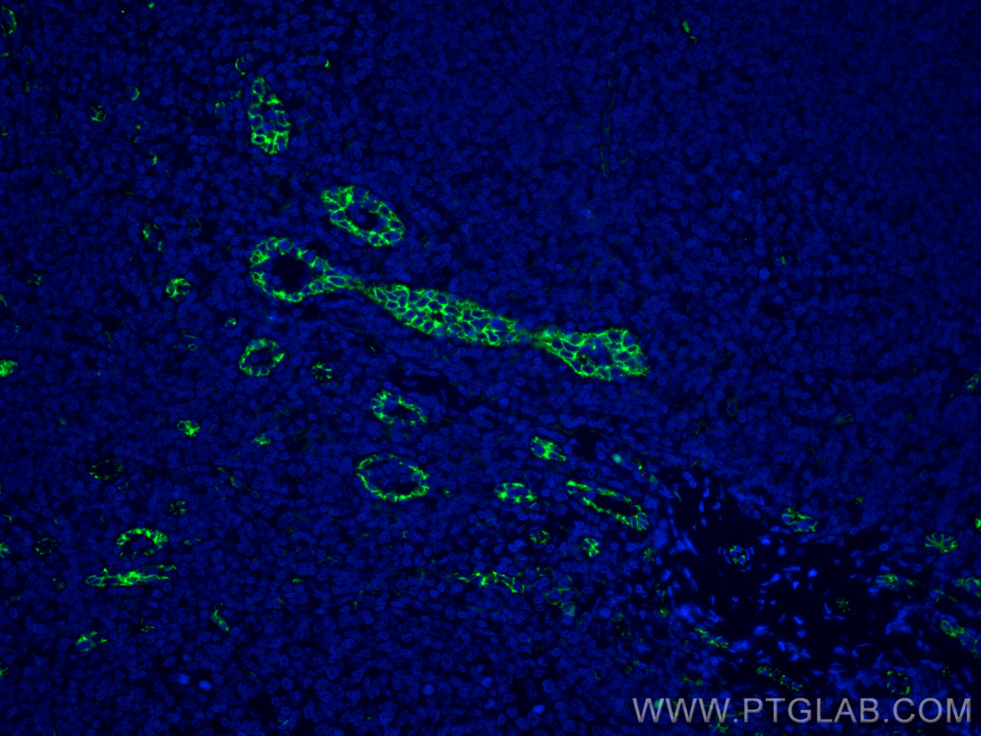 IF Staining of human tonsillitis using CL488-66065
