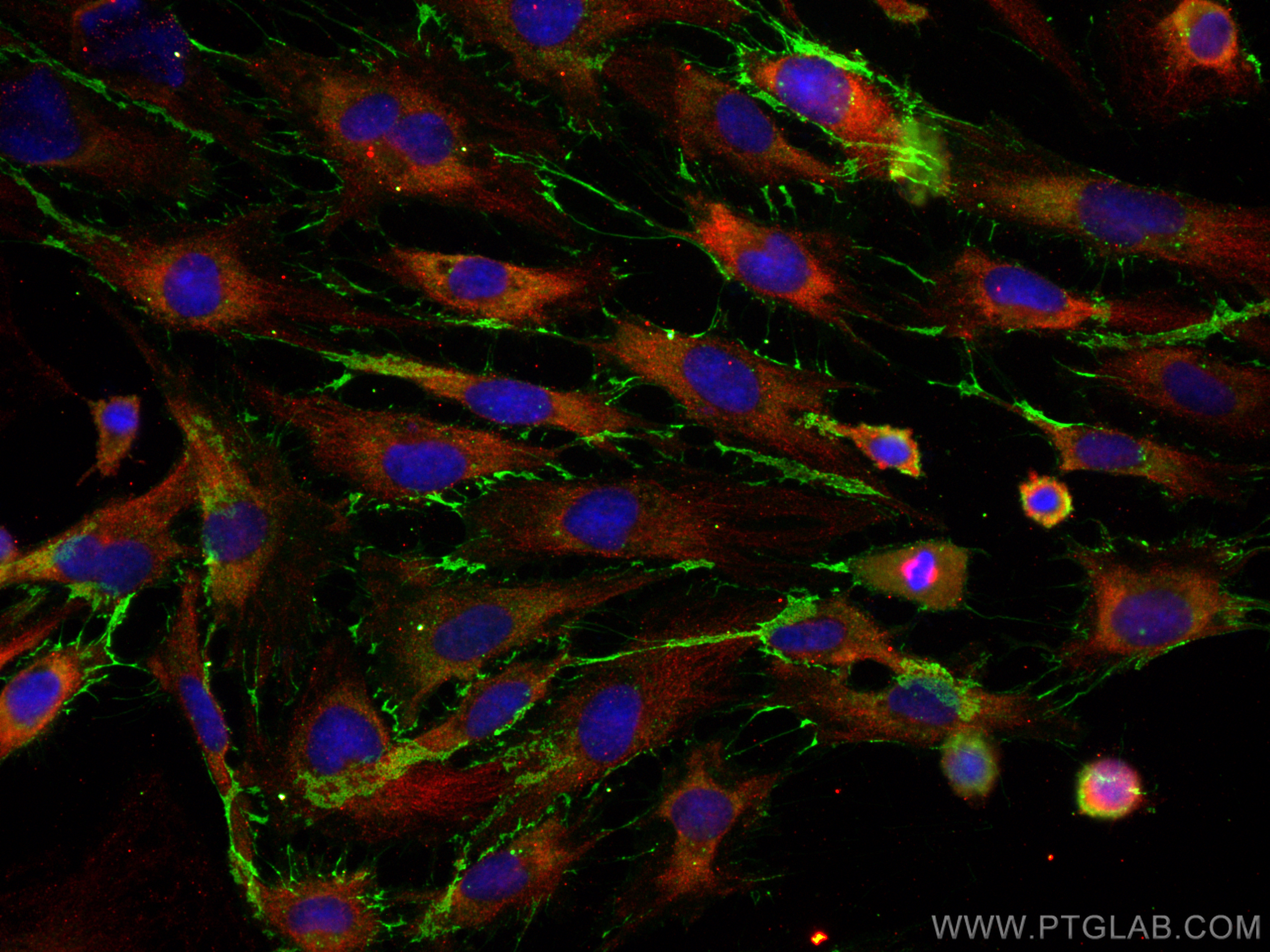 IF Staining of HUVEC using CL488-80530