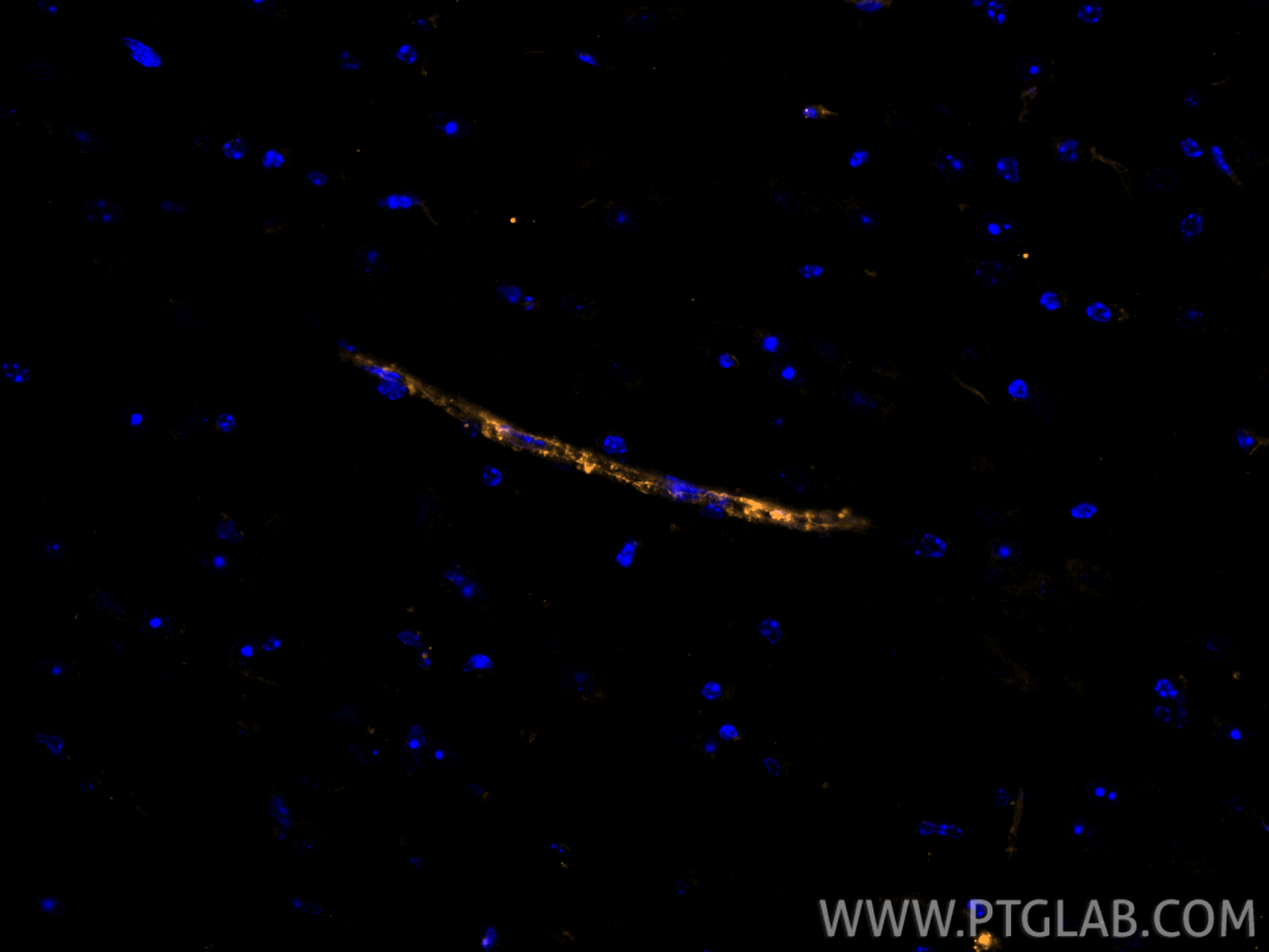 IF Staining of mouse brain using CL555-28083