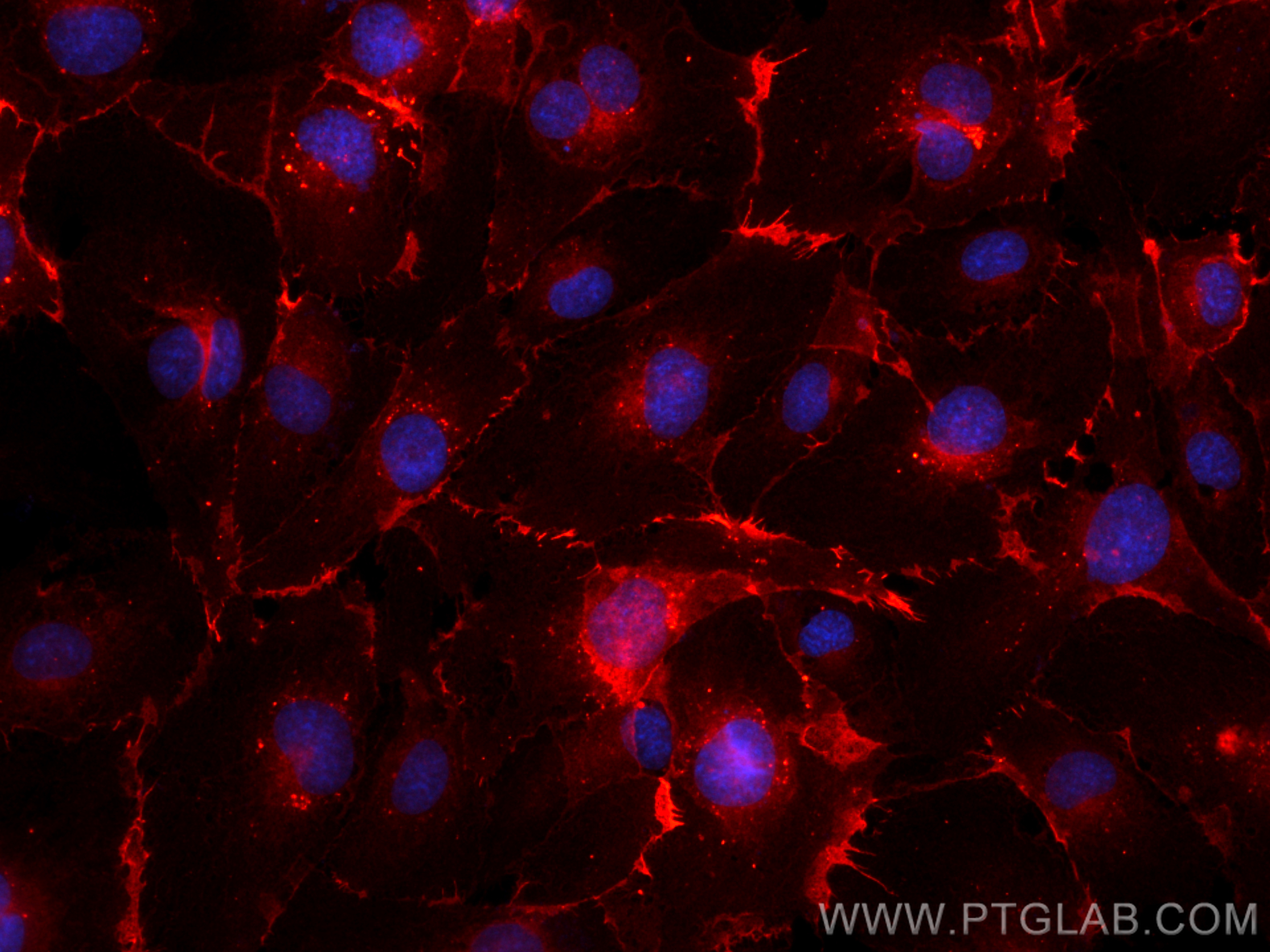 IF Staining of HUVEC using CL594-11265