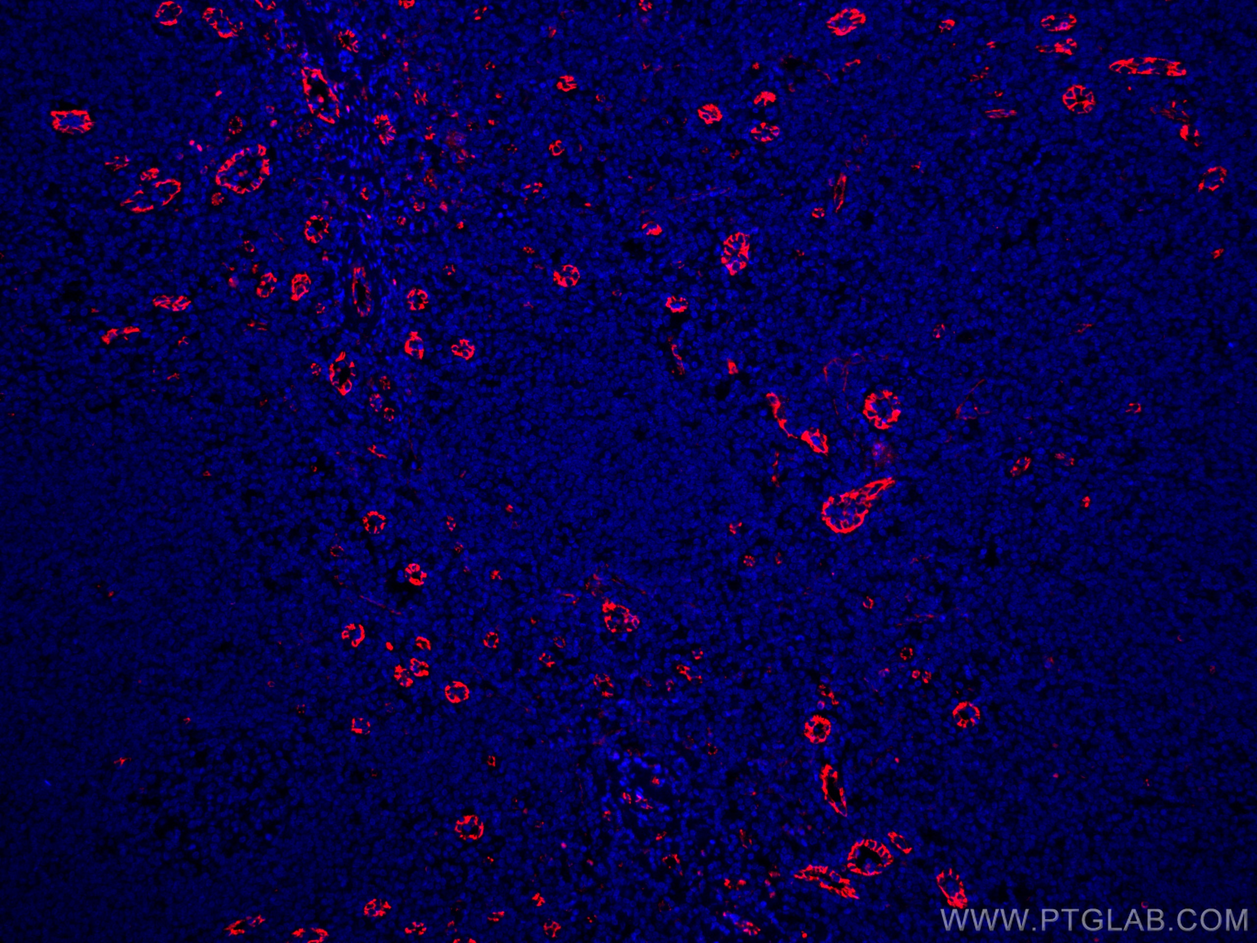 IF Staining of human tonsillitis using CL594-66065