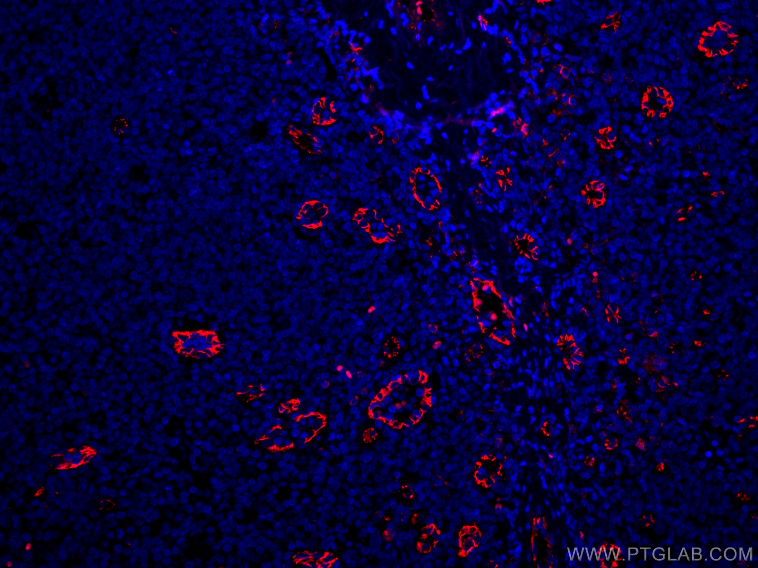 IF Staining of human tonsillitis using CL594-66065