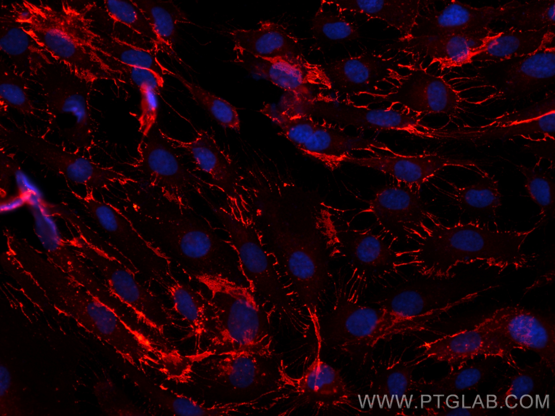 IF Staining of HUVEC using CL594-80530