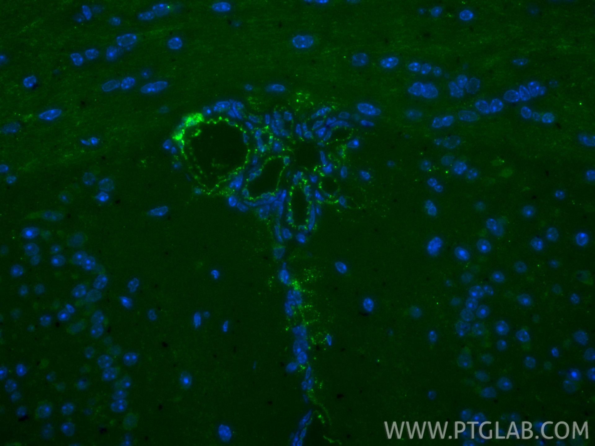 IF Staining of mouse brain using FITC-28083 IF Staining of mouse brain using FITC-28083