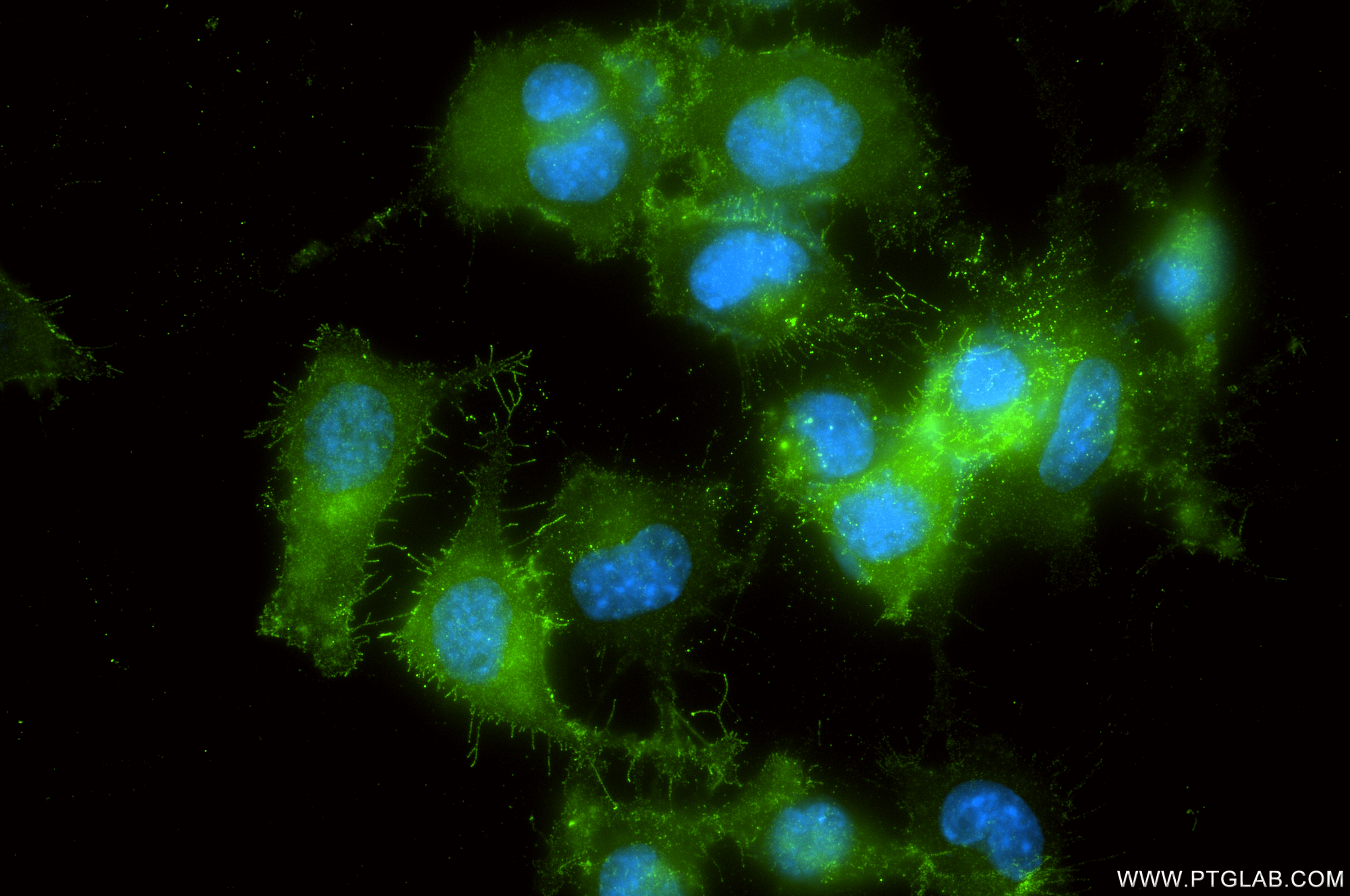 Immunofluorescent analysis of (4% PFA) fixed Neuro-2a cells using CD316/IGSF8 antibody (<a class='green' href='/productredirect?CatalogNo=87310-1-RR' target='_blank'>87310-1-RR</a>, Clone: 252500B3 ) at dilution of 1:200 and CoraLite®488-Conjugated Goat Anti-Rabbit IgG(H+L) (<a class='green' href='/productredirect?CatalogNo=SA00013-2' target='_blank'>SA00013-2</a>). This data was developed using the same antibody clone with 87310-1-PBS in a different storage buffer formulation. IF Staining of Neuro-2a using 87310-1-RR (same clone as 87310-1-PBS)