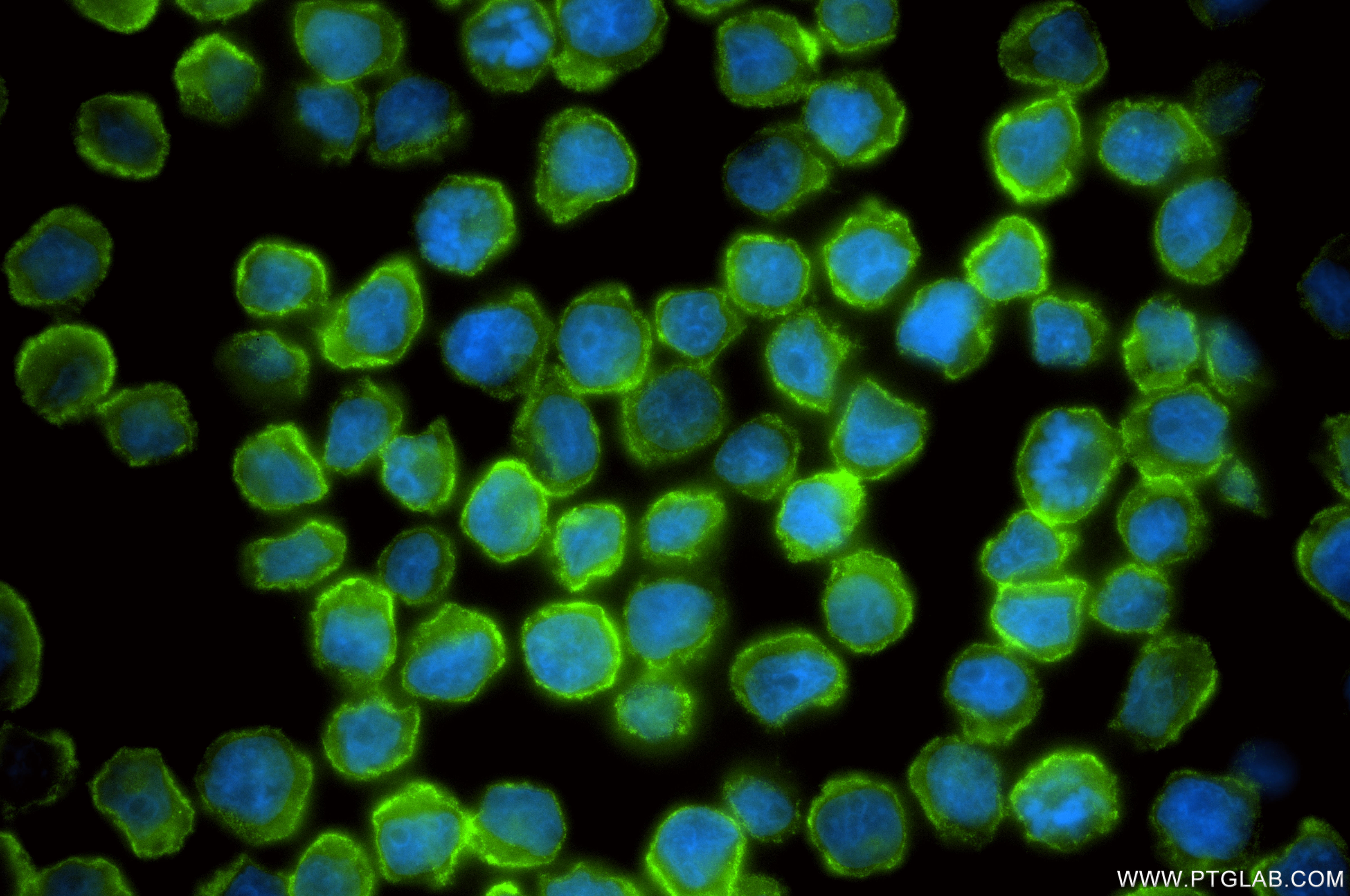 Immunofluorescent analysis of (4% PFA) fixed U-937 cells using CD32 antibody (<a class='green' href='/productredirect?CatalogNo=86588-2-RR' target='_blank'>86588-2-RR</a>, Clone: 251087D9 ) at dilution of 1:200 and CoraLite®488-Conjugated Goat Anti-Rabbit IgG(H+L) (<a class='green' href='/productredirect?CatalogNo=SA00013-2' target='_blank'>SA00013-2</a>). This data was developed using the same antibody clone with 86588-2-PBS in a different storage buffer formulation. IF Staining of U-937 using 86588-2-RR (same clone as 86588-2-PBS)