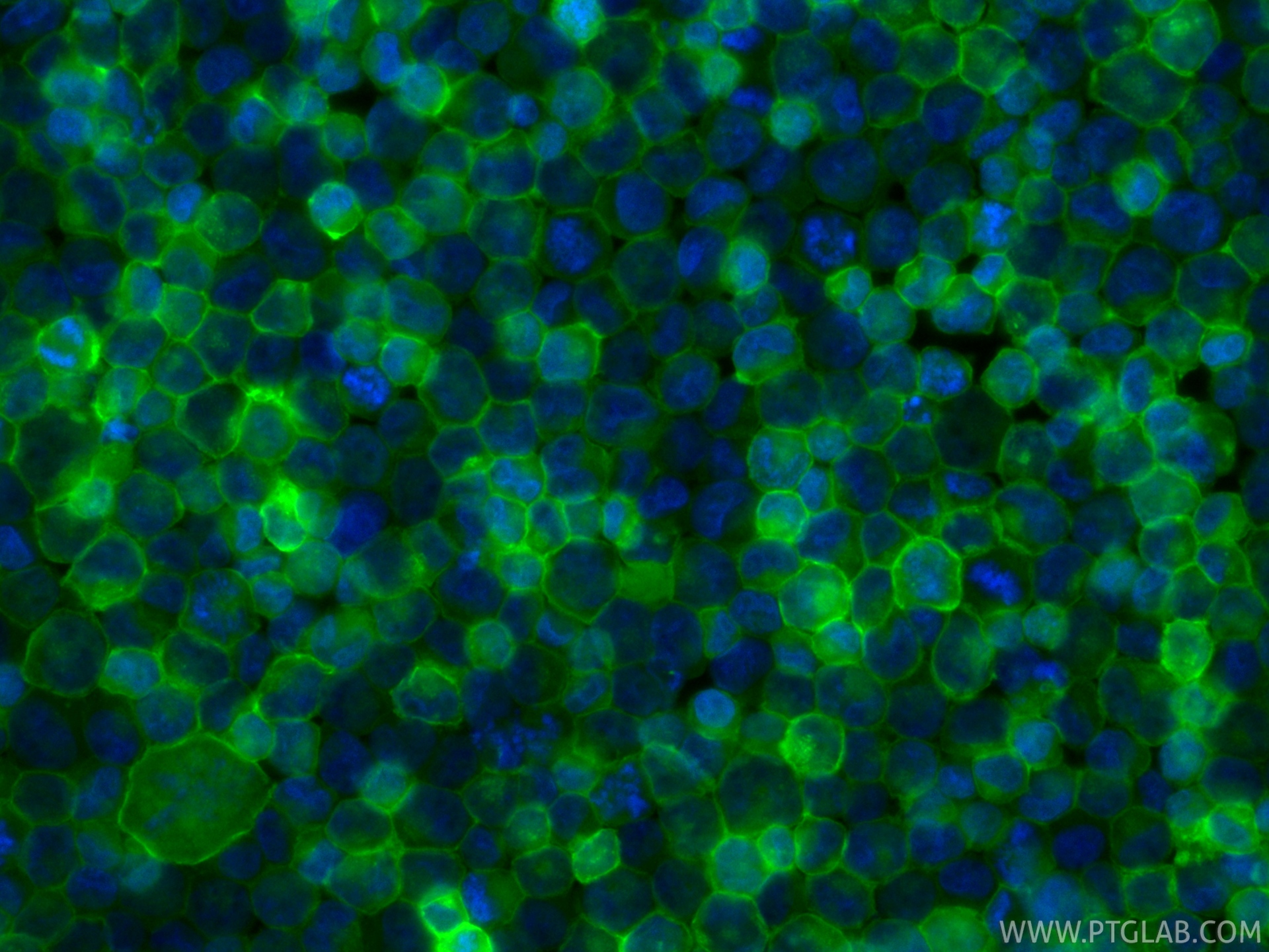 IF Staining of K-562 using CL488-86588-2 IF Staining of K-562 using CL488-86588-2