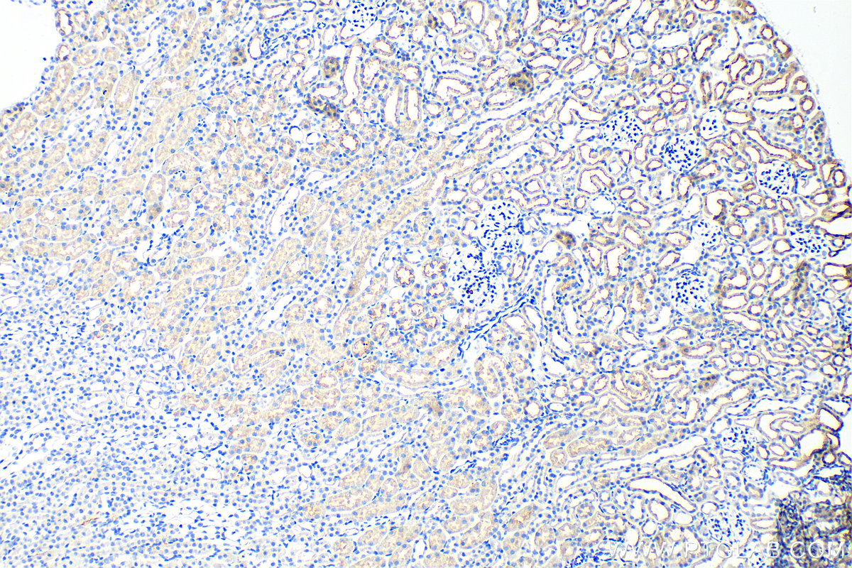 CD320 antibody (103431AP) Proteintech 武汉三鹰生物技术有限公司