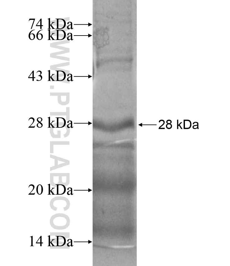 CD320 fusion protein Ag17605 SDS-PAGE CD320 fusion protein Ag17605 SDS-PAGE